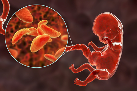 feto e globuli rossi