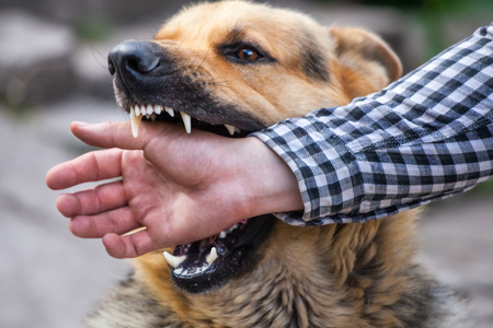 Un cane che morde una mano umana