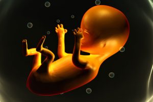 feto umano intossicato da mercurio